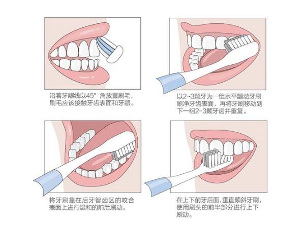 電動牙刷如何配巴氏刷牙法